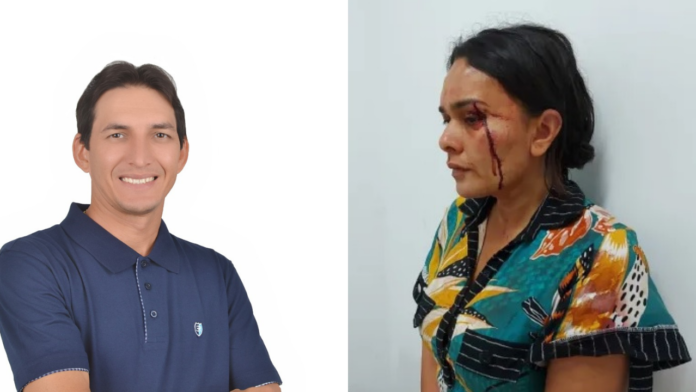 Justiça expede mandado de prisão contra ex-candidato a prefeito de Matinha, acusado de agredir ex-esposa e atropela outras duas pessoas